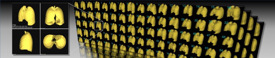 「ビッグデータ」を活用した手術支援　－　生体医用画像研究室