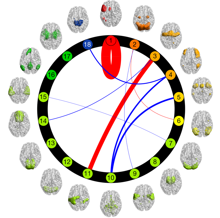 Fig.2 Brain network supporting a cognitive function (working memory)